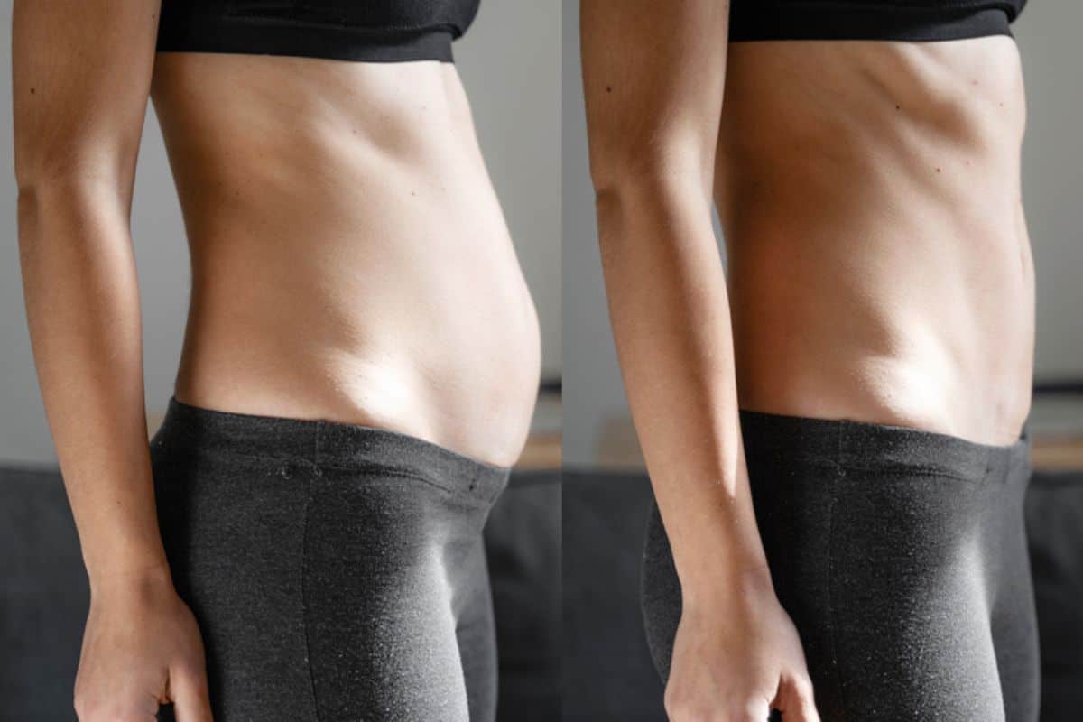 Post-Pregnancy: What Happens to Your Abdominal Muscles After Birth Northolt