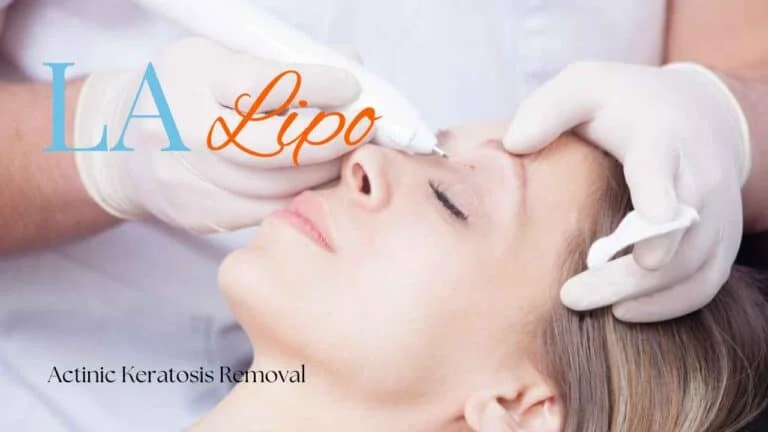 Woman receiving Actinic Keratosis Removal Treatment Northolt
