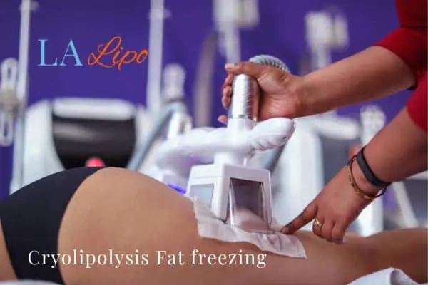 women getting fat freezing Northolt