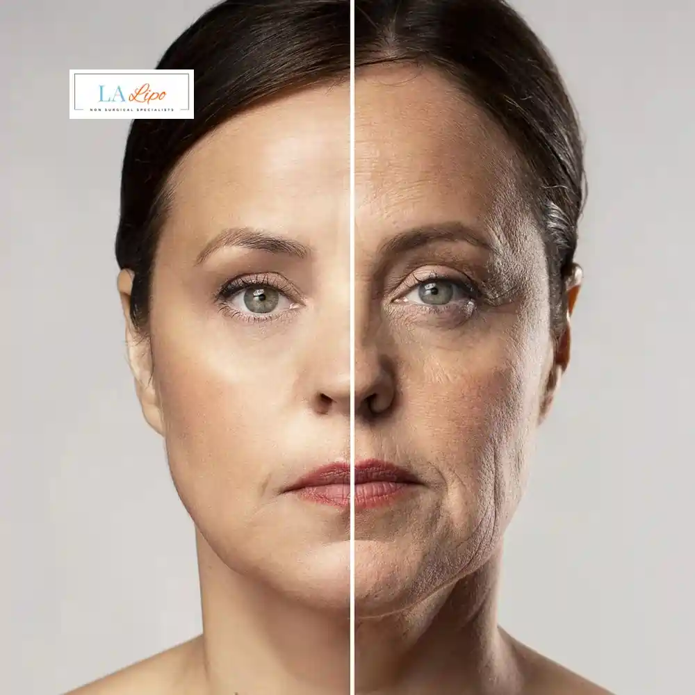 How Can You Tell If Non-Surgical Skin Tightening Is Right for You Northolt?