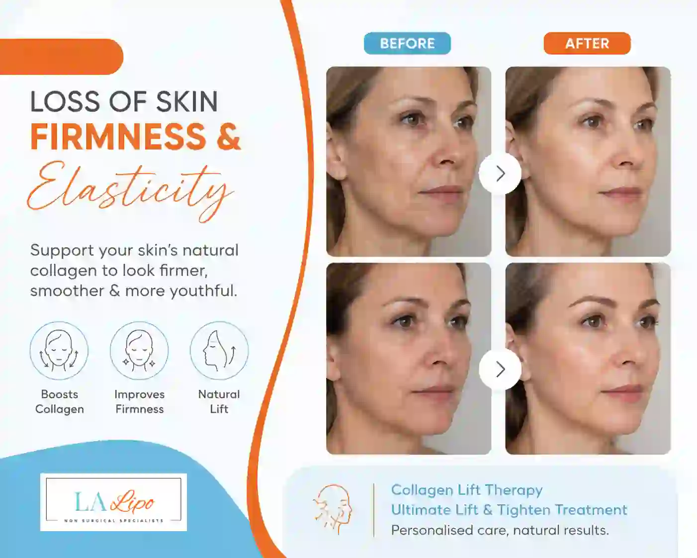 Sign #7: Loss of Skin Firmness and Elasticity Northolt