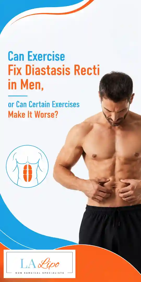 Can Exercise Fix Diastasis Recti in Men, or Can Certain Exercises Make It Worse Northolt?